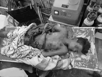 TV फटने से युवक की मौत, 2 जख्मी ; धमके से 500 मीटर तक आवाज़ सुनाई दिया