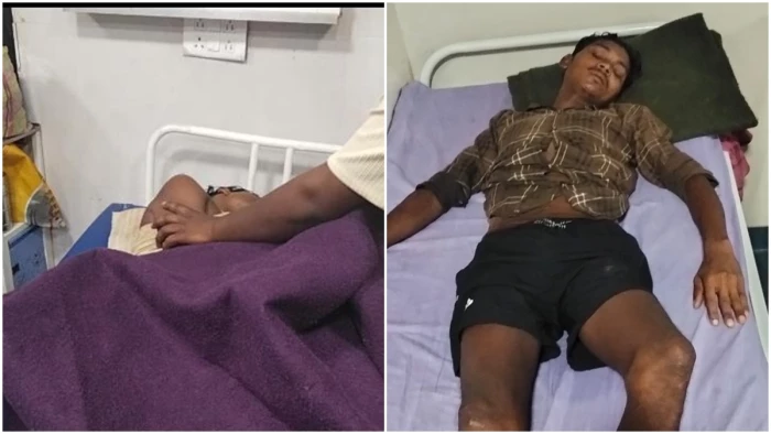 दंतेवाड़ा के चंदेनार साप्ताहिक बाजार में गिरी आकाशीय बिजली, 11 लोग चपेट में आए