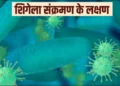 Shigella Alert: इस राज्य में फेल रहा है शिगेला संक्रमण का प्रकोप: बच्चों में बढ़ते मामले, अब तक इतने की मौत की पुष्टि